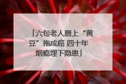 六旬老人唇上“黄豆”拖成癌 四十年烟瘾埋下隐患
