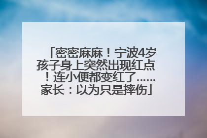 密密麻麻！宁波4岁孩子身上突然出现红点！连小便都变红了……家长：以为只是摔伤